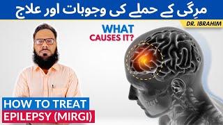 Mirgi Ka Ilaj - Mirgi Ka Dora - How to Treat Epilepsy (Seizures) - Urdu, Hindi - Dr. Ibrahim