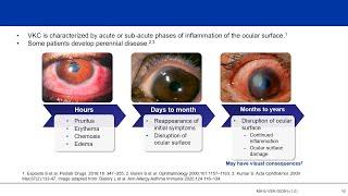 Understanding Vernal Keratoconjunctivitis (VKC): Not “Just an Allergy”