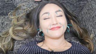 Facial Acupuncture By Dr. Jennifer Ng | New York Live TV