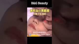 B&G Beauty高端私人訂制專業項目：半永久 眼線 美瞳線 沙霧眼線 髮線  飄 霧眉  野生眉 #飄霧眉 男士開運眉改紅藍眉 修眉形 歐洲漂唇   改烏唇 無創傷洗眉  洗眼線 #眼睛 #眼線