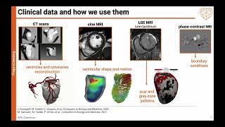 Alfio Quarteroni (Polimi, EPFL) - Physics and data-driven mathematical models for the heart function