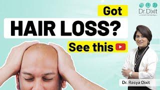 Does Vitamin D Deficiency Cause Hair Loss?  | Hair Fall Causes and Treatment | Dr. Rasya Dixit