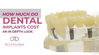 How Much Do Dental Implant's Cost | An In Depth Look Dental Boutique