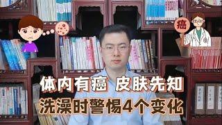 身体有癌，皮肤先知？提醒：皮肤出现4种异常，或是癌症信号【梁怡璋医生】