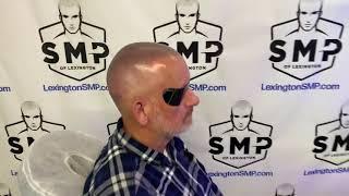 Scalp Micropigmentation for 60 year old | SMP of Lexington