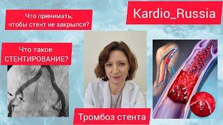 🫀 Что пить из лекарств, чтобы стент не закрылся? Стентирование - это надолго?