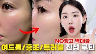 ️한 달만에 꿀피부 되는 루틴 찾았다! 초강력 트러블 3단루틴 (자세함주의) NO광고