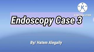 Endoscopy Case 3