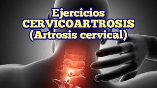 Ejercicios para ARTROSIS CERVICAL (Cervicoartrosis)