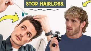 Going Bald?? Here's What You Can ACTUALLY DO | Hair Loss Prevention