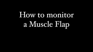 MONITORING MUSCLE FLAPS