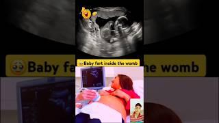 Baby farts inside the womb showing ultrasound #short