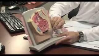 Robotic Surgery for Pelvic Organ Prolapse | UCLA Obstetrics & Gynecology