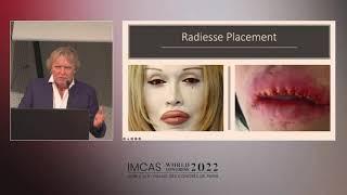 Prof, Dr Treacy speak about twenty years of dealing with Aesthetic Complications