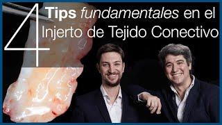 ️Injerto de TEJIDO CONECTIVO o injerto de encía ️ 4 Tips Imprescindibles en [Implantes Dentales]