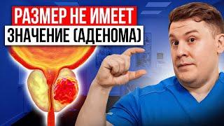 ЭТИ 4 ОБСЛЕДОВАНИЯ ПОМОГУТ С ЛЕЧЕНИЕМ АДЕНОМЫ