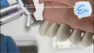 Finishing & polishing tools & application (2): Class III, IV, V composite restorations - En