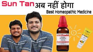 Sun tan अब नही होगा | Best Homeopathic Medicine for Sun tan ?