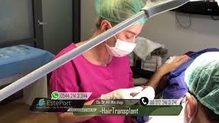 Hair Transplant Turkey - Istanbul - Esteport Clinic