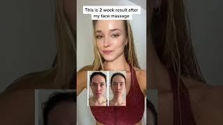 2 Week Face Massage Results (Client Before/After)