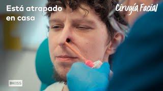 Se le desprendió la nariz de la cara mientras se rascaba | Cirugía Facial