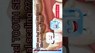 Tooth Sensitivity after dental scaling - Why???