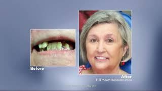 EXTREME SMILE MAKEOVERS | Dr. Nathan Faber – Charleston, SC Dentist