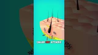 Why Hair Loss? Explained with 3d Animation. #shorts #animation #hair #education