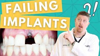 What Causes DENTAL IMPLANT FAILURE? | Dr. Brett Langston