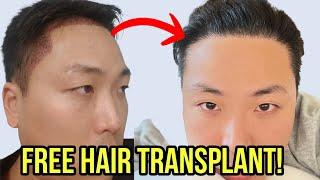 FREE HAIR TRANSPLANT GIVEAWAY AT MOTION CLINIC!! **SIGN UP NOW!!*** //CLOSED//