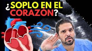 ¿Tienes un Soplo en el Corazón? NADIE te explica esto...