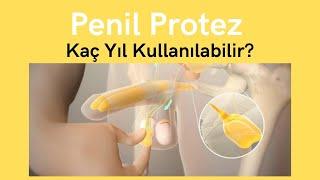 Penil Protez (Mutluluk Çubuğu) Kaç Yıl Kullanılabilir? -Prof. Dr. Ömer Faruk Karataş