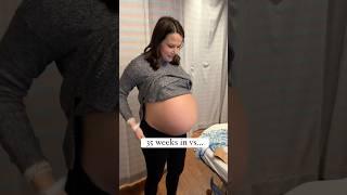 35 weeks in the Belly vs 35 weeks out! #triplets #baby #mom #dad #cute