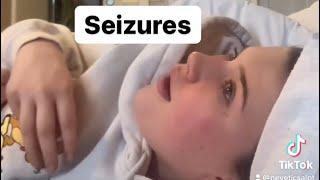 Recording a seizure