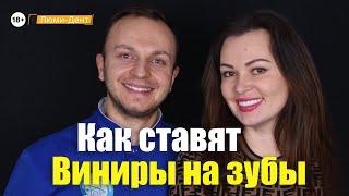 Виниры для зубов Киев: установка до и после, как ставят виниры на зубы (Видео)