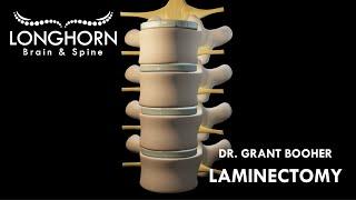 Longhorn Brain and Spine - Laminectomy