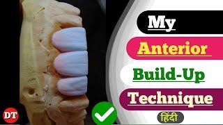 My Anterior Build up techniques|| Anterior Ceramic porcelain| dental technician| posterior| anatomy|