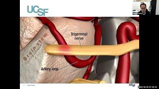 Facing the Challenges of Trigeminal Neuralgia | UCSF Neurosurgery Community Grand Rounds