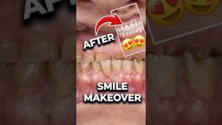 This Smile Makeover Will Blow Your Mind! 