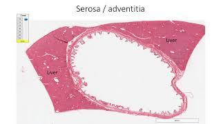 Histology with Chimmalgi: Gallbladder