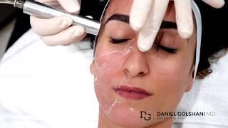 Skin Care Tips With Dr. Golshani