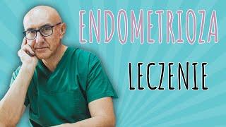 ENDOMETRIOZA - leczenie