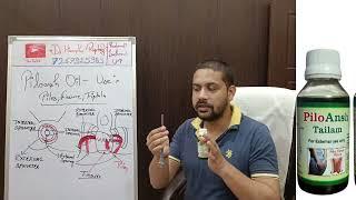 PILOANSH OIL -Piles Fissure heal easily