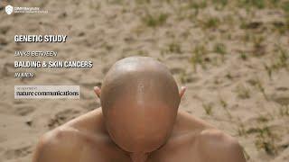 Balding linked to skin cancer, research confirms