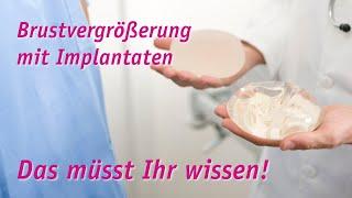 Brustvergrößerung mit Implantaten - nice to know!