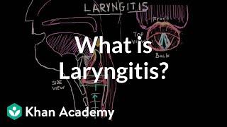 What is laryngitis ? | Respiratory system diseases | NCLEX-RN | Khan Academy