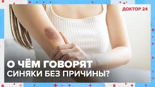 О чём говорят СИНЯКИ на теле без причины? | Доктор 24