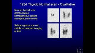 Thyroid functioning imaging