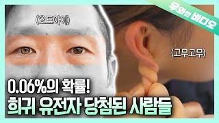 엄청난 확률로 초초초초희귀 유전자 당첨된 행운의 사람들┃The Luckiest People Ever with RARE Gene