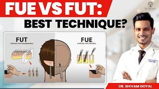 क्या FUT Better है या FUE? Everything You Need to Know About Hair Transplant – Myths and Facts!